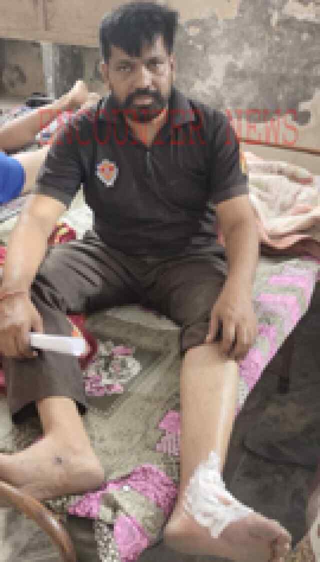 जालंधरः कूड़ा के डंप में आग लगने से झुलसा दमकल कर्मी