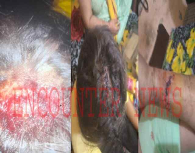 Jalandhar: गली में सब्जी बेच रहे युवक पर 6 हथियारबंद बदमाशों ने किया हमला