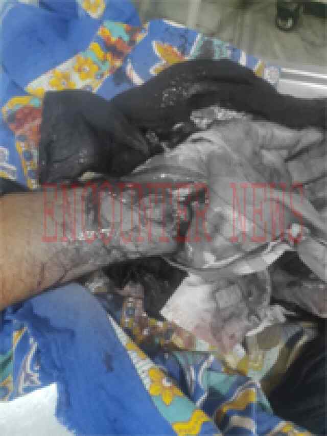Jalandhar: इस इलाके में हुई खूनी झड़प, व्यक्ति का कटा गुट, हालत गंभीर
