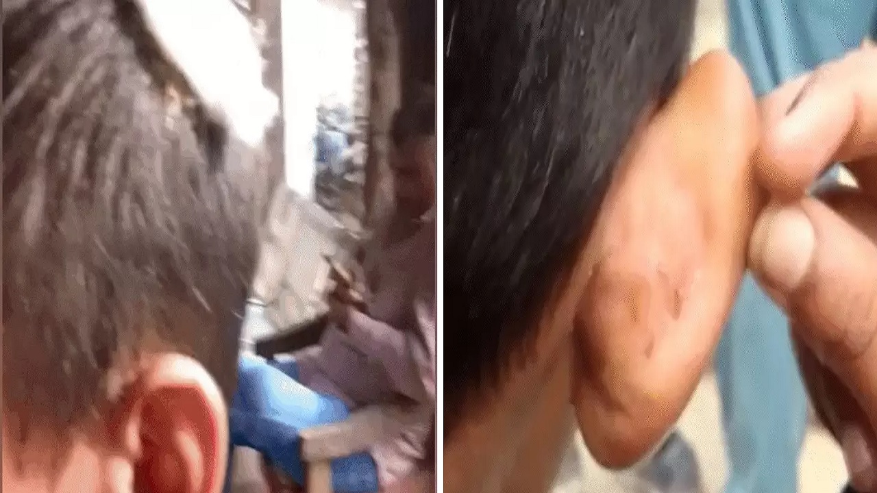 Homework न करने पर Teacher ने छात्र के सिर में मारी Steel की Bottle, फिर दीवार पर पटका, गंभीर घायल