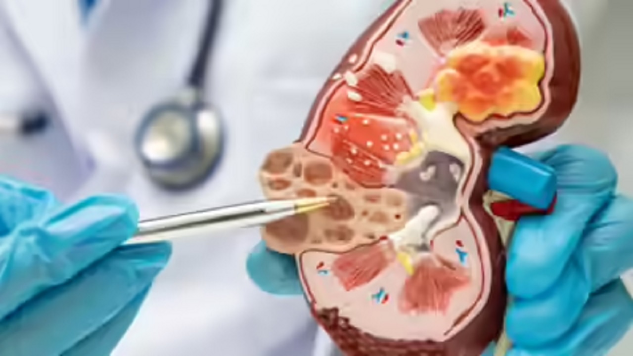 सावधान! ये वजह बन सकती है kidney Damage का कारण