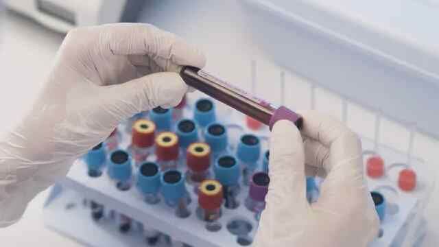गलत Blood Group का खून चढ़ाने से होगी शरीर को ये दिक्कतें, जानें