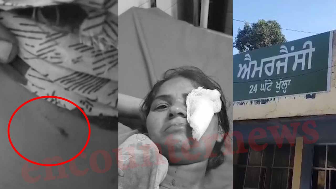 Punjab News: आवारा कुत्ते ने 6 वर्षीय बच्ची सहित 2 लोगों को काटा, देखें वीडियो