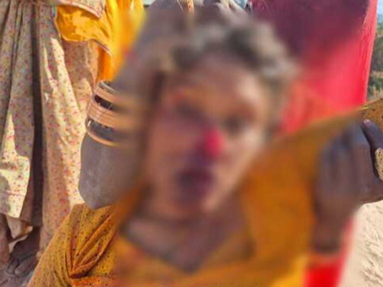 प्लाट के विवाद में भतीजे ने चाकू से काटी चाची की नाक