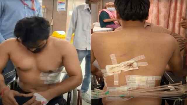 12 हजार रुपए को लेकर हुआ विवाद, युवक के पेट में मारा पेचकस