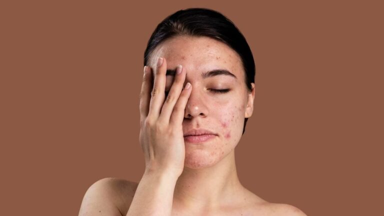 चेहरे पर दाग-धब्बों से परेशान है तो इस्तेमाल करें ये घरेलू नुस्खे