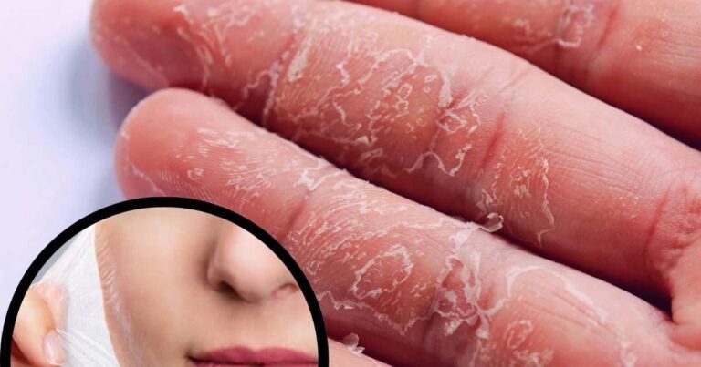 ज्यादा देर धूप में रहने से हो सकता है Skin Cancer? सर्दियों में भी हो जाएं सावधान, देखें वीडियो