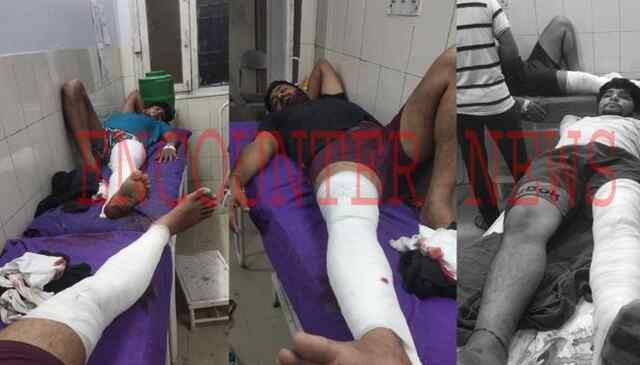 Police और बदमाशों में चली गोलियां, 3 शूटर घायल